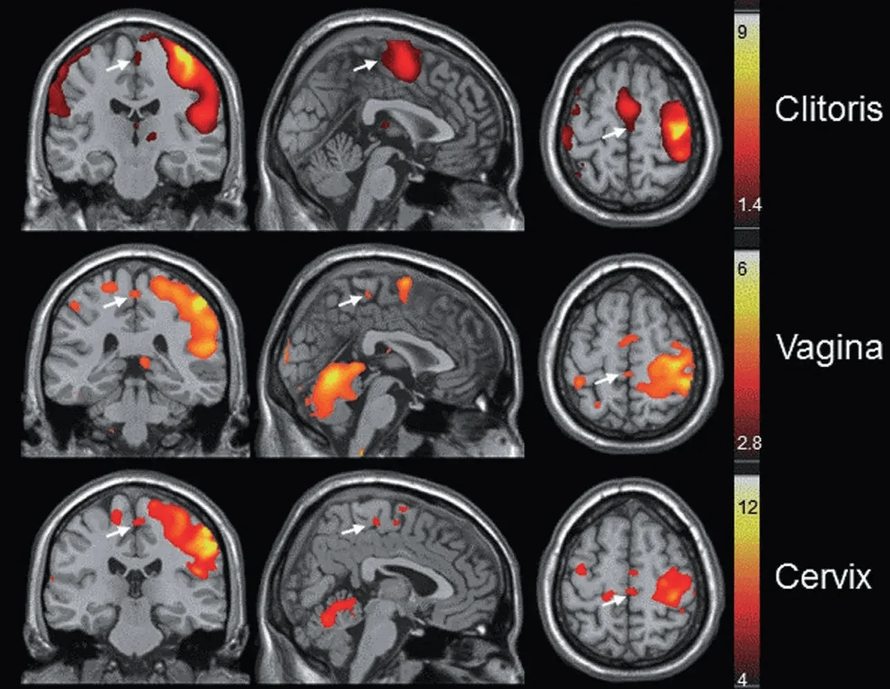 fMRI brain activation scans showing clitoris, vagina, and cervix stimulation response